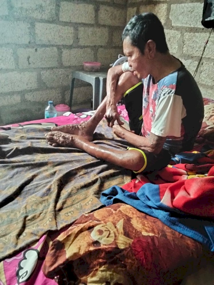 Polsek Fatuleu Berikan Bantuan Kursi Roda untuk Warga Penderita Kusta